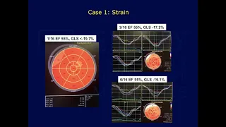 Emory Cardiology Grand Rounds 04-20-2020