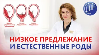 Низкое предлежание плаценты. Возможны ли естественные роды? Дементьева С.Н.