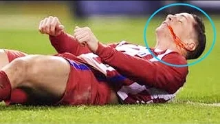 اصابة فرناندو توريس الخطيرة جدا Fernando Torres Serious injury