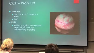 Ocular Cicatricial Pemphigoid Peripheral Ulcerative Keratitis Dr David Chu