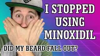 I Stopped Using Minoxidil Almost 2 Years Ago - Did My Beard Fall Out?