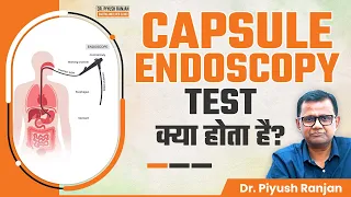 क्या है Capsule Endoscopy Test? जानें कब और क्यों किया जाता है? | Dr. Piyush Ranjan