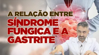 A Relação entre a Síndrome Fúngica e a Gastrite