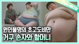 온몸이 살로 뒤덮여 힘들어하는 거구 손자와 할머니의 일상┃Days of Grandmother and Her Grandson with Super-obesity