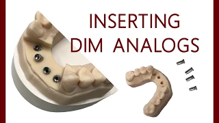 How To Insert DIM Analogs In A 3D Printed Model | Dental Lab Learning