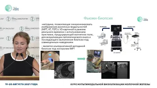 Фьюжн-биопсия образований молочных желез,относящихся к категории BI-RADS 4 и BI-RADS 5 по данным МРТ