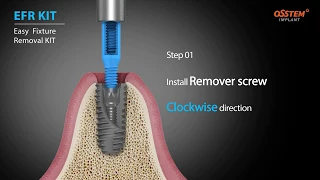 Hiossen   EFR Kit   Overview