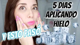 5 Días de usar HIELO en la CARA * Tratamiento Facial Perfecto para la Piel*