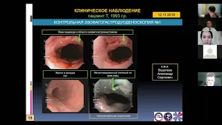 2. Пирогов С.С., Беляева Т.В. Рак пищевода Барретта у пациента 25 лет:   клиническое наблюдение