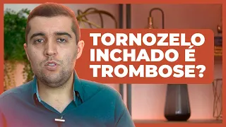 Será que tornozelo inchado é trombose, ou pode ser algo ainda mais grave? Tem risco alto de embolia?