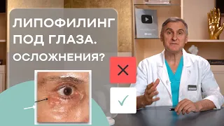 ЛИПОФИЛИНГ ПОД ГЛАЗА 👁 УБРАТЬ СИНЯКИ ПОД ГЛАЗАМИ  👁 ЕСТЬ ЛИ ОСЛОЖНЕНИЯ?