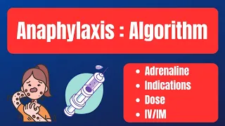 Anaphylaxis Algorithm || How to treat Anaphylaxis