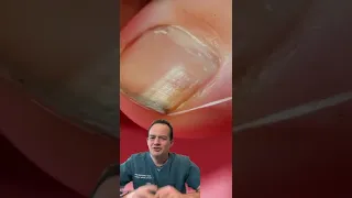 DOCTOR REACTS: FLOSSING YOUR TOENAILS?!😱😳