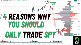 Trading Was Hard Until I focused on SPY | Day Trading Spy Options | SPY SPX /ES VIX