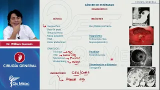 Cáncer de estómago, Neoplasias gastrointestinales - CIRUGÍA GENERAL ENAM 2023