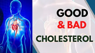 Cholesterol: Know Everything About HDL and LDL Cholesterol | Good & Bad Cholesterol