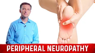 How to Relieve Peripheral Neuropathy Pain? – Dr. Berg