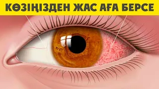 Көз Жасаураса не істейміз, КӨЗДЕН ЖАС  АҒУЫ ҚОЙМАСА ОСЫЛАЙ ІСТЕҢІЗ, Керек арнасы