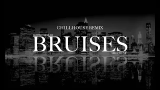 Lewis Capaldi - Bruises - CHILLHOUSE REMIX - VISUALIZER [Lyrik Video]