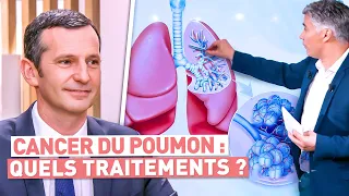 Cancer du poumon : quelles prises en charge ?