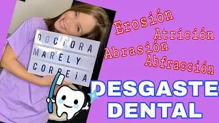 Desgaste Dental / Tipos de Desgaste Dental #60