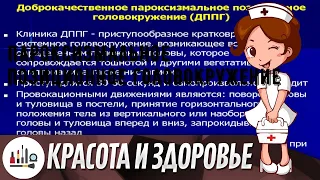 Пароксизмальное позиционное головокружение