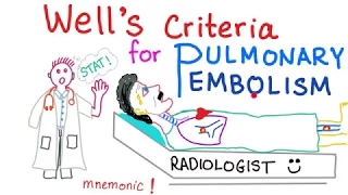 Well's Criteria for Pulmonary Embolism (with a mnemonic)!
