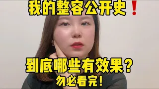 【韩国整形】我的整容公开史！都有哪些医美项目值得做？