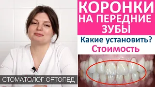 Зубные коронки на передние зубы: какие установить? Виды коронок для зубов, материалы, цена, гарантия