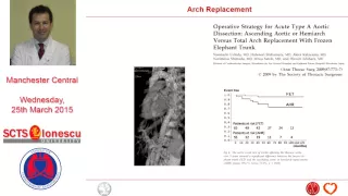 Re-intervention Following Acute Type-A Aortic Dissection Repair: the IRAD Perspective