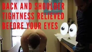 Back & Shoulder Tightness Relief Before Your Eyes! (THIS WORKS!!)