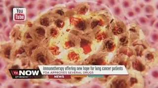 Immunotherapy offering new hope for lung cancer patients