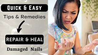 7 Tips How to Heal Damaged Nails After Acrylic Or Gel