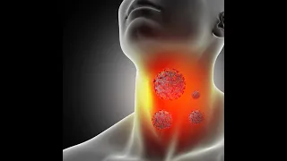 Symptoms of Esophagus Cancer @DrAshishSachan