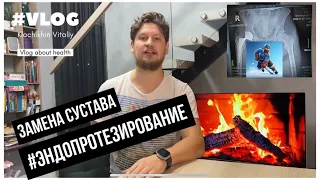 Замена сустава! Реабилитация! Как жить с эндопротезом? Боль по утрам!