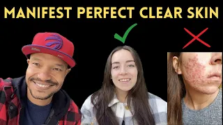 How To Manifest Perfect Clear Skin | Law of Assumption