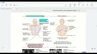 Respiratory medicine part 2