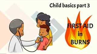 Burns first aid (English)