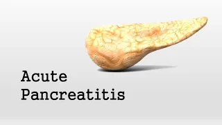 Acute Pancreatitis