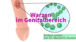 Warzen im Genitalbereich - Ursache & Behandlung - Einfach erklärt von Dr. Durani