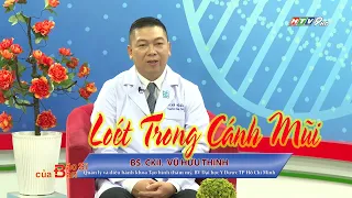 Loét trong cánh mũi | Bác Sĩ Của Bạn || 2023