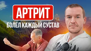 Артрит, болел каждый сустав