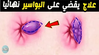 افضل علاج يقضي على البواسير نهائيا