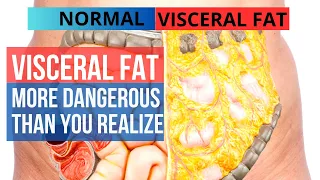 Why Visceral Fat is More Dangerous than You Think | The Role of Visceral Fat in Health and Disease