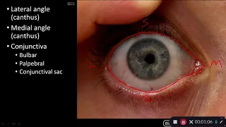 Orbit and Eye - Conjunctiva