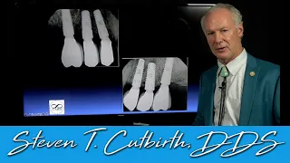 Full Mouth Reconstruction with Sinus Lifts & Implants - Dental Minute with Steven T. Cutbirth, DDS