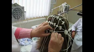 Електроенцефалографія ЕЕГ