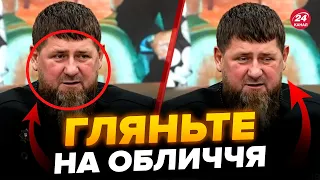 🤯КАДИРОВ смертельно хворий! Уперше ВИЛІЗ на ЛЮДИ після цих чуток