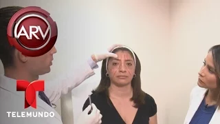 Alertan contra inyecciones para rejuvenecer el rostro | Al Rojo Vivo | Telemundo