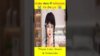 OMG🤯Under Arm में हुआ Infection🤯। wait for end@CarryMinati #cartoon #animation #asmr #shorts